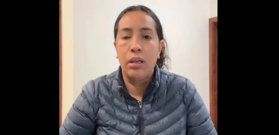Arrojan ácido a rostro de una mujer emprendedora en Tijuana
