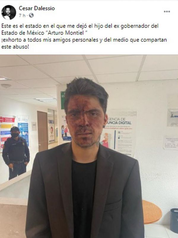 Arturo Montiel acusado por hijo de Lupita DAlessio por agresión. 